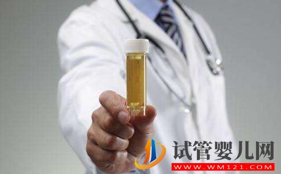 试管婴儿检查报告有效期是多长?各项检查都一样吗(图3) 试管婴儿检查报告有效期是多长?各项检查都一样吗(图3)
