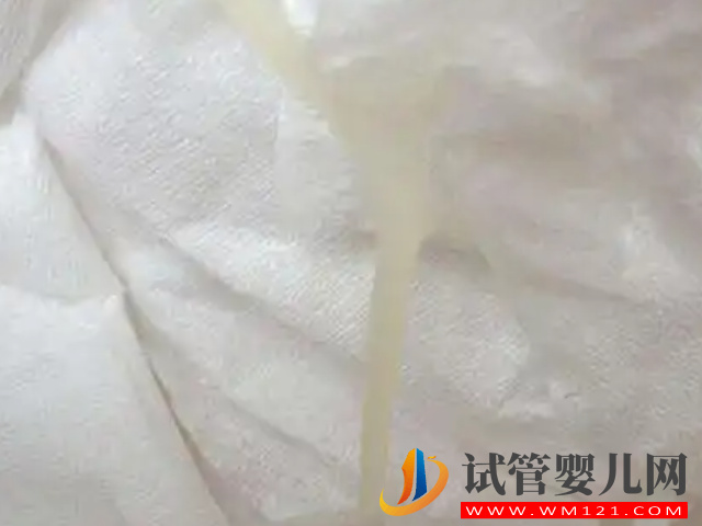 一图看清胚胎着床成功排出的白带表现，呈水样、发黄都是好“孕”(图2)