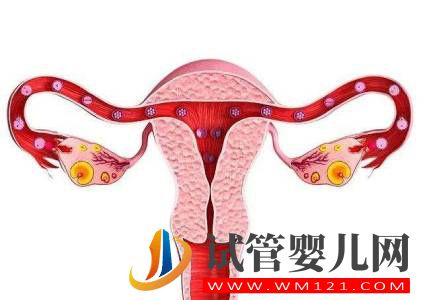 那些因素会造成卵巢不孕? 那些因素会造成卵巢不孕?(图1)