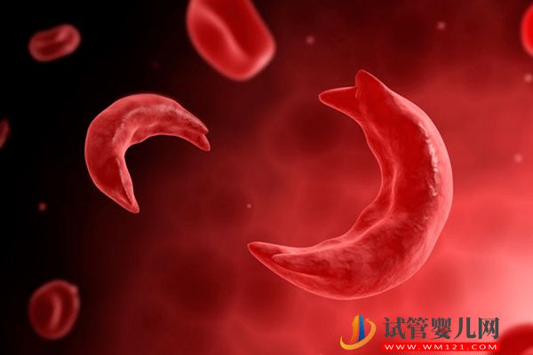 地中海贫血要做几代试管，医生：这2种情况才适合别搞错了(图2)
