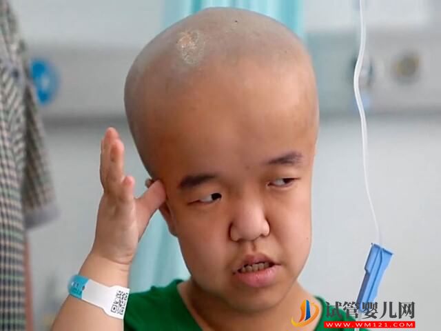 人体第19号常染色体出现三体的后果都有哪些?(图1) 人体第19号常染色体出现三体的后果都有哪些?(图1)