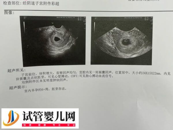 内膜移植窗口期一共查几次(图1)