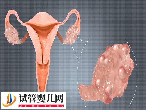 做试管输卵管积水有没有影响(图2)