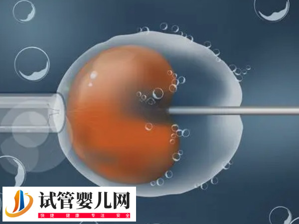 在俄罗斯做试管步骤是什么(图3)