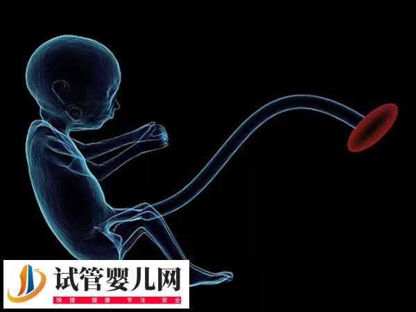 试管出生双胞胎的健康与什么有关(图1)