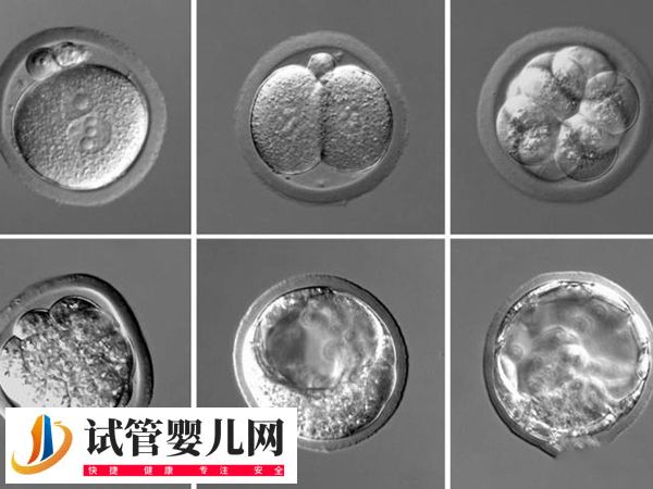 在美国做试管优质胚胎是啥样的(图3)
