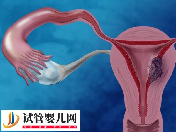 攀枝花试管医院哪家好(图2)