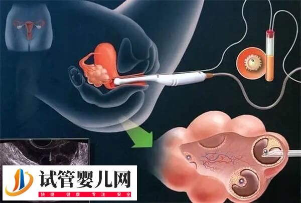 取卵后有淤血块流出正不正常(图1)