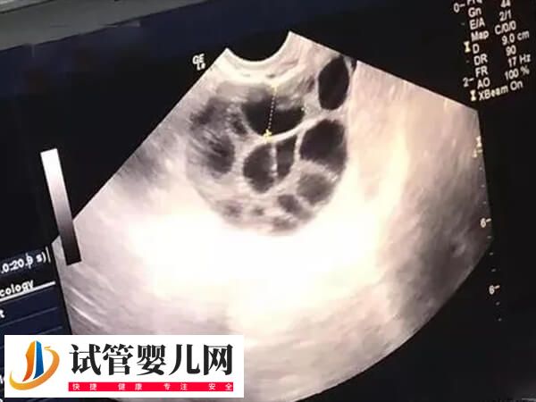 绝经了还能不能做试管婴儿(图2)