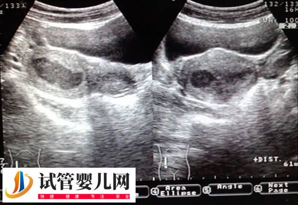 试管为什么有的人一次成功(图2)