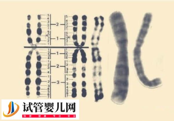 Y染色体微缺失能否做试管(图2)