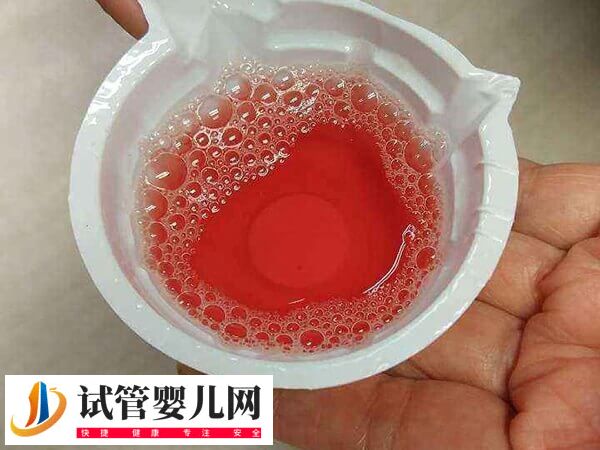 做试管胎停是胚胎质量问题