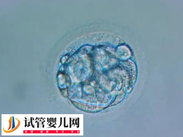 移植后胚胎质量不好是什么原因