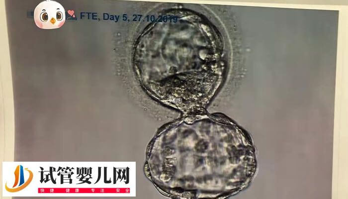移植后胚胎质量不好是什么原因(图2)