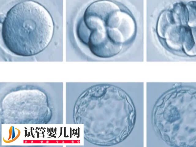 囊胚移植有什么优点