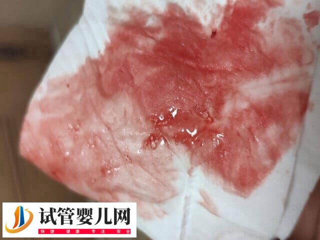 囊胚移植失败有什么症状