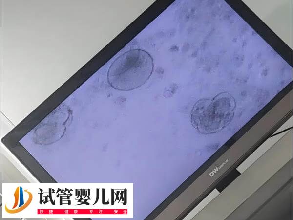 没达到冷冻标准的囊胚能否移植(图1)