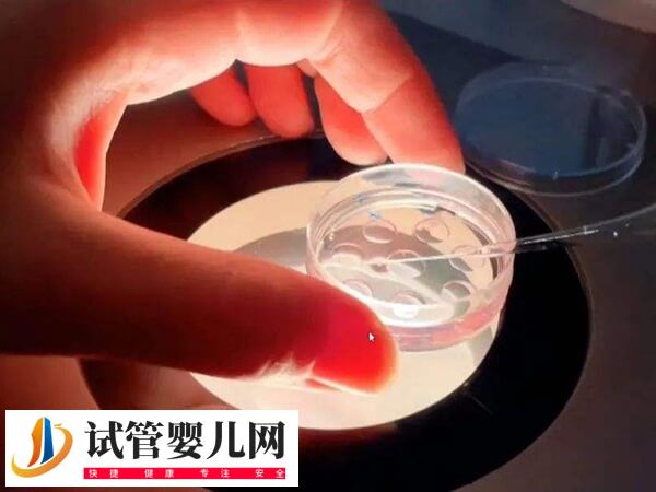 做试管胚胎是如何移植的(图2)