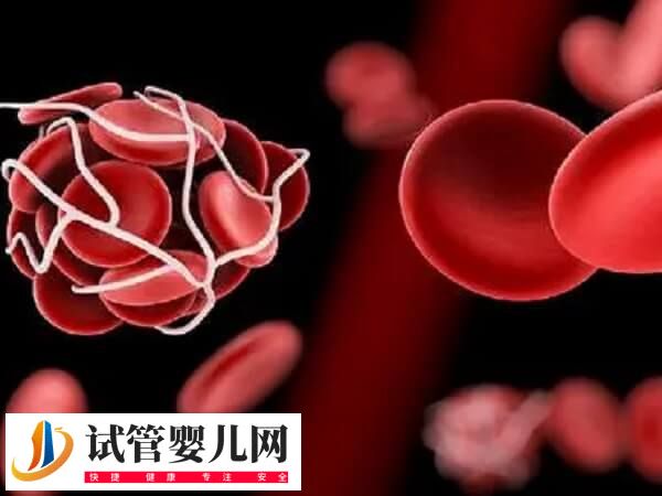 胚胎移植后为何不能一直躺