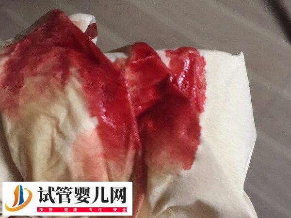 试管移植失败后有什么症状