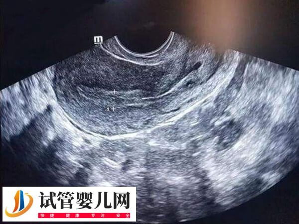 深圳三代试管的医院有哪些(图3)