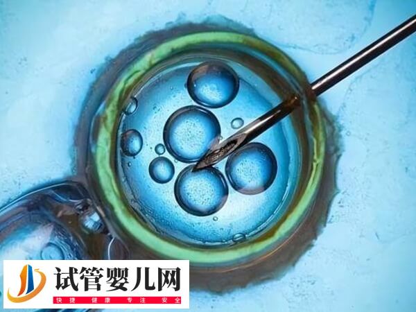 谨慎移植的成功率有多少(图1)