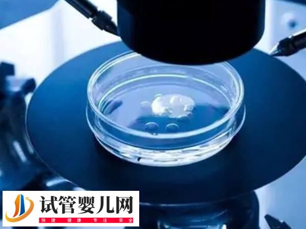 三代试管婴儿能不能筛查鱼鳞病(图2)