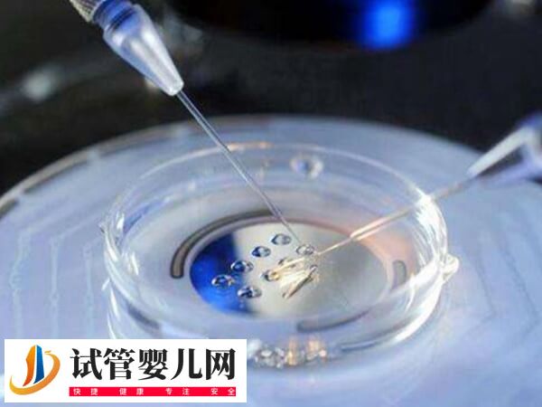三代试管婴儿能不能筛查鱼鳞病(图1)