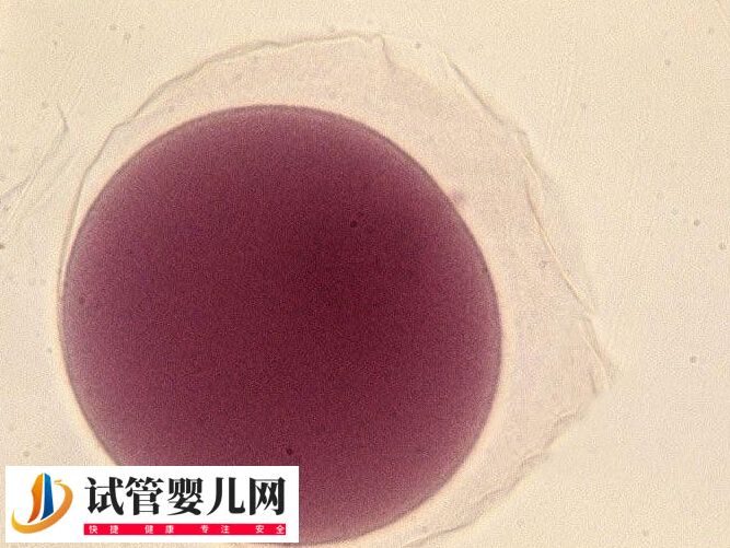 胚胎辅助孵化技术安不安全