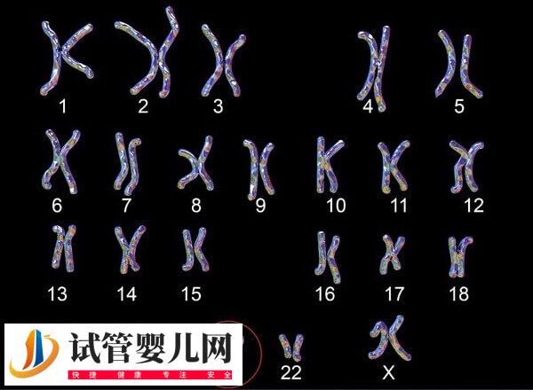 22号染色体异常会有哪些遗传病(图2)