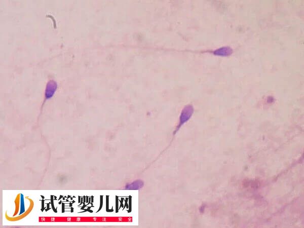 女性骨髓造精多少钱(图1)