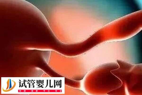 子宫切除手术有哪5种(图4)
