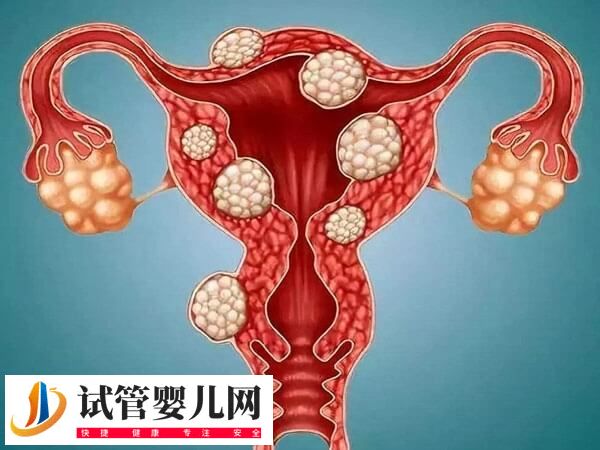 子宫切除手术危害大不大(图1)