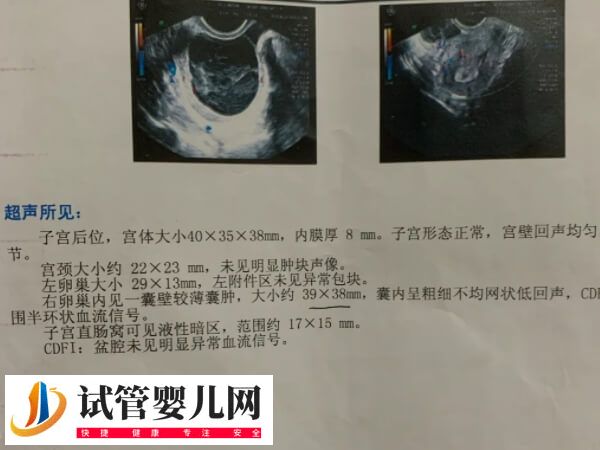 子宫切除手术危害大不大(图2)