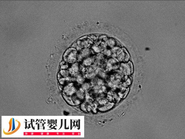 30%嵌合体胚胎能不能做试管婴儿移植(图1)