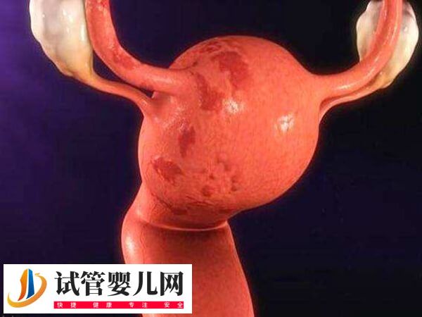 子宫内膜容受性什么意思(图1)