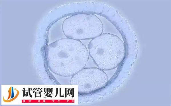 高龄做试管婴儿怎样合理备孕