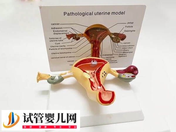 子宫畸形的有哪些(图1) 子宫畸形的有哪些(图1)