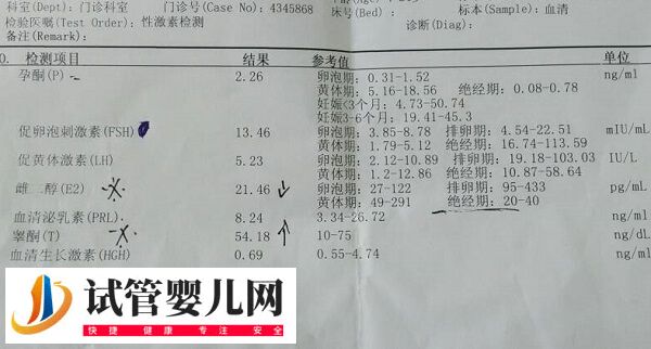 fsh促卵泡素高于20能不能做试管(图1) fsh促卵泡素高于20能不能做试管(图1)