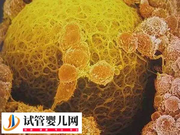 卵泡发育不良能不能做试管婴儿(图3)