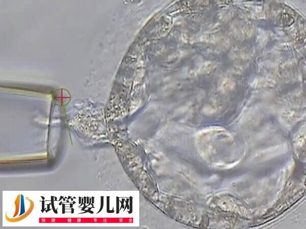 隔了3天卵泡才长了1mm正不正常(图2)