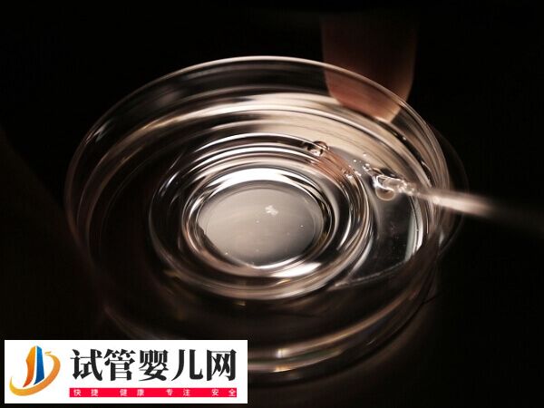 第四代试管婴儿适不适合大龄女性(图1)