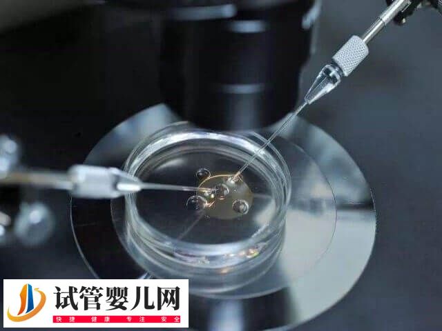 先天性肾积水能不能做试管(图1)