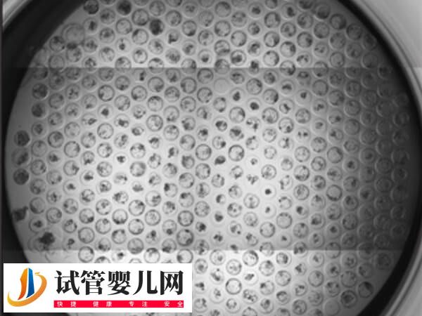 试管胚胎透明带厚的原因是什么(图1)