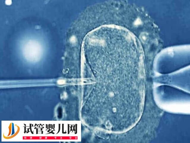 三代试管费用高不高(图1)
