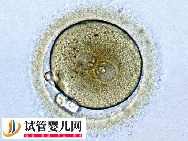 试管移植后生化了是什么原因(图1)