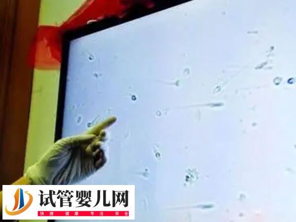 精子库精子生的孩子丑不丑(图2)