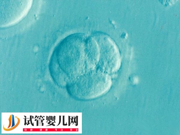 试管取卵全过程要多久