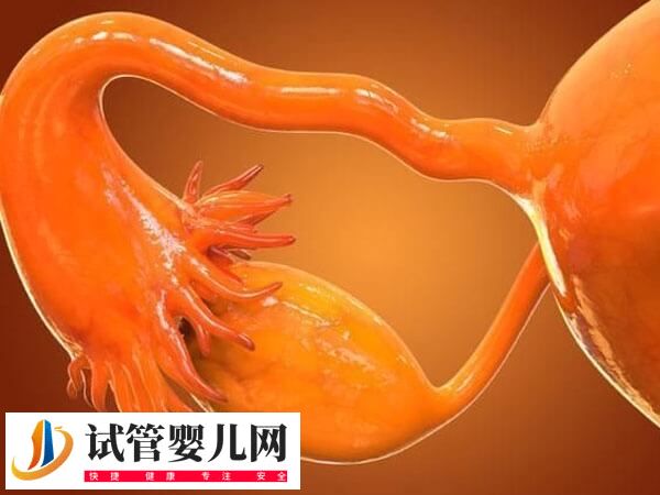 输卵管堵塞要不要做试管婴儿