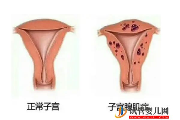 去美国生孩子后美宝能否回国上学(图1)